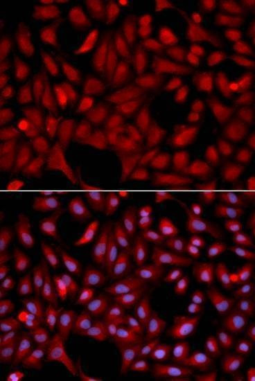 Anti-SIAH1 Antibody