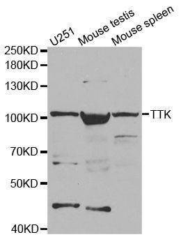 Anti-TTK Antibody