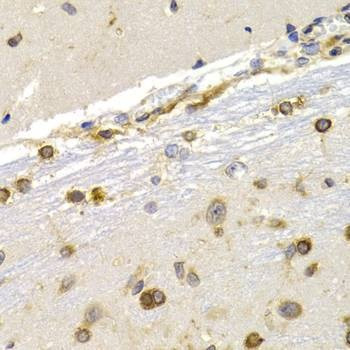 Anti-EEF1D Antibody