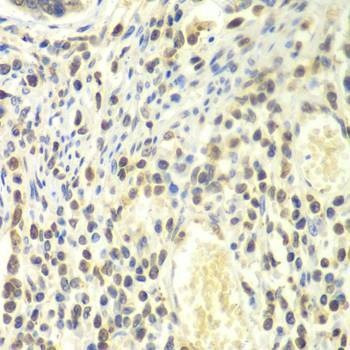Anti-PSMA4 Antibody