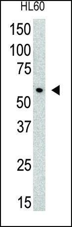Anti-PIAS3 (N-term) Antibody