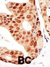 Anti-PIAS3 (N-term) Antibody