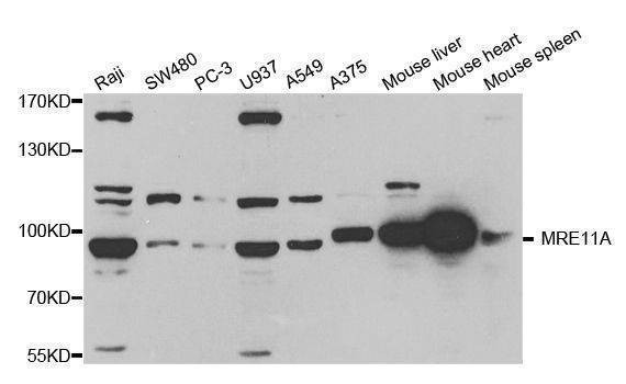 Anti-MRE11A Antibody