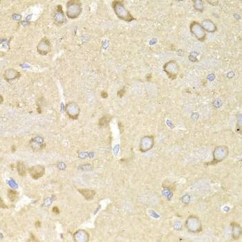 Anti-TRAP1 Antibody