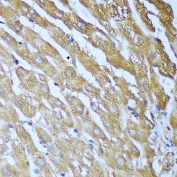 Anti-IGF2BP3 Antibody