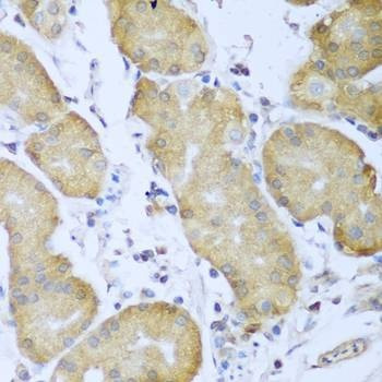 Anti-IGF2BP3 Antibody