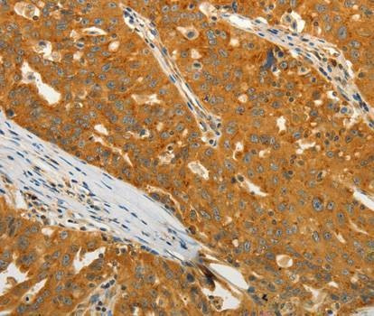 Anti-USO1 Antibody