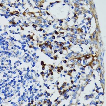 Anti-USO1 Antibody