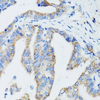 Anti-USO1 Antibody