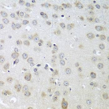 Anti-ACHE Antibody