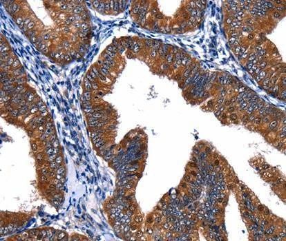 Anti-CUL4A Antibody