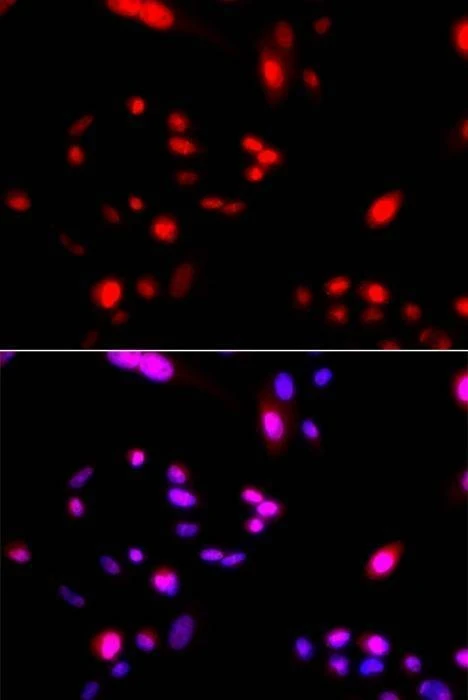 Anti-CUL4A Antibody