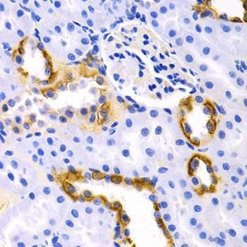 Anti-DRD1 Antibody