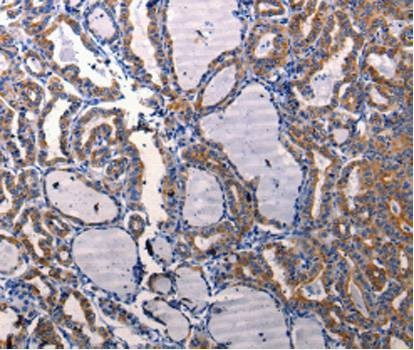 Anti-DRD1 Antibody