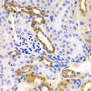 Anti-DRD1 Antibody