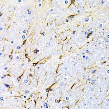 Anti-DRD1 Antibody