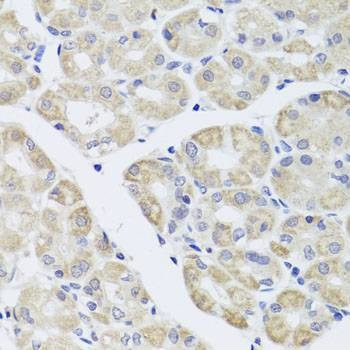 Anti-DISC1 Antibody