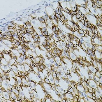 Anti-CLDN3 Antibody