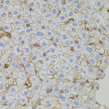 Anti-CLDN3 Antibody