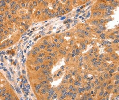 Anti-GRM8 Antibody