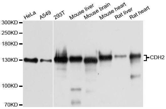 Anti-CDH2 Antibody