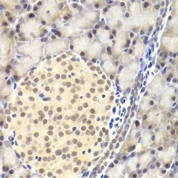 Anti-PAWR Antibody