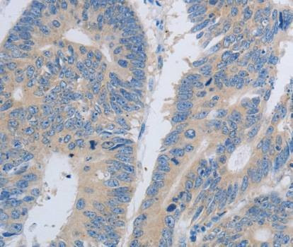 Anti-PAWR Antibody