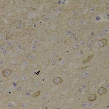 Anti-ADCYAP1R1 Antibody