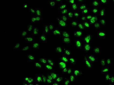 Anti-SETD2 Antibody