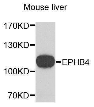 Anti-EPHB4 Antibody