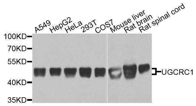 Anti-UQCRC1 Antibody