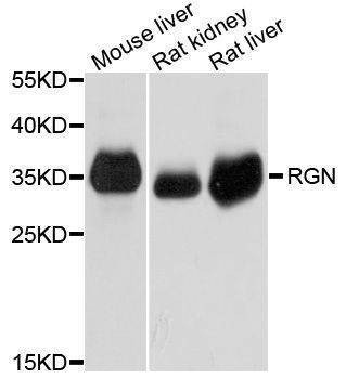 Anti-RGN Antibody