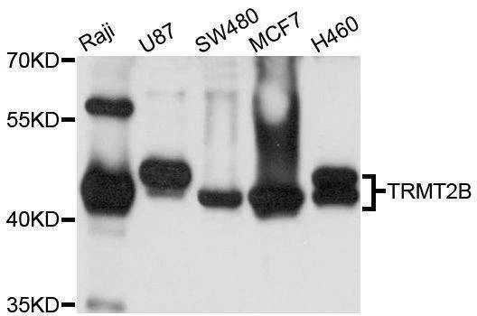 Anti-TRMT2B Antibody