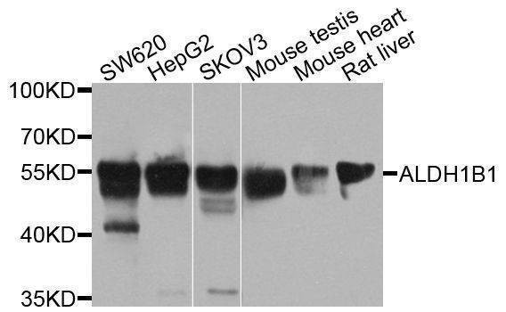 Anti-ALDH1B1 Antibody