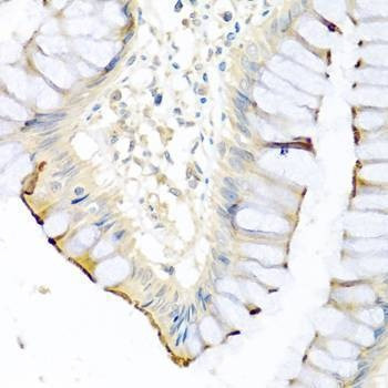 Anti-CPA1 Antibody