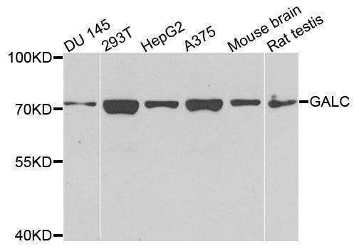 Anti-GALC Antibody