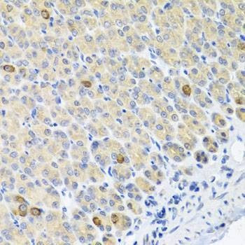 Anti-GLS Antibody