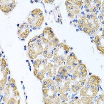 Anti-GLS Antibody