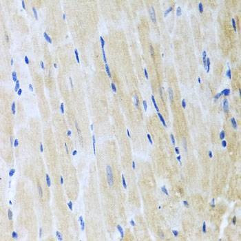 Anti-ITPKB Antibody