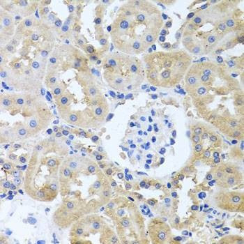 Anti-ITPKB Antibody