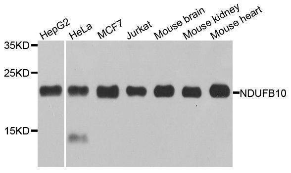 Anti-NDUFB10 Antibody