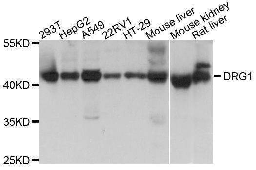 Anti-DRG1 Antibody