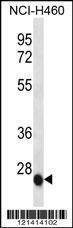 Anti-IL6 (Center) Antibody