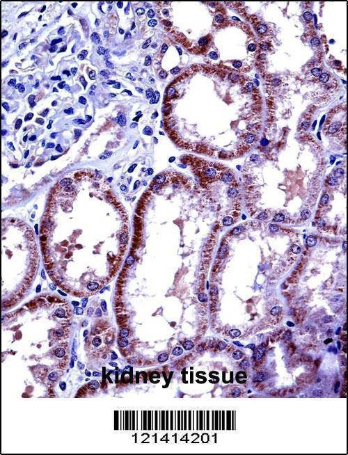 Anti-IL6 (Center) Antibody