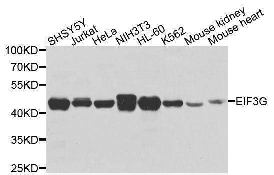 Anti-EIF3G Antibody