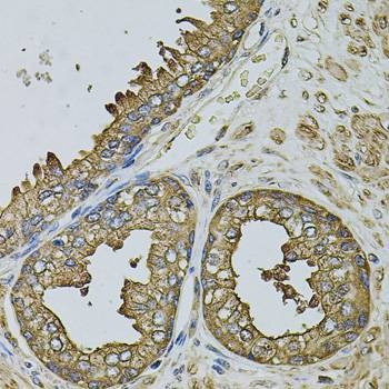 Anti-EIF1AY Antibody