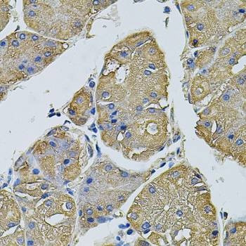 Anti-EIF1AY Antibody