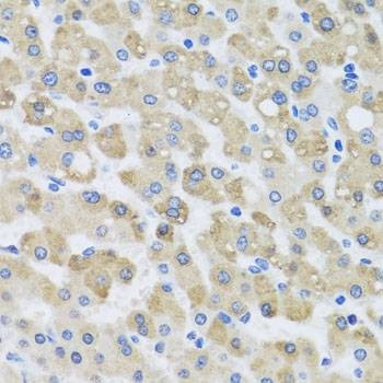 Anti-SNAP29 Antibody