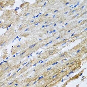 Anti-SNAP29 Antibody