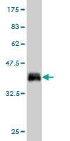 Anti-CALCOCO2 Antibody